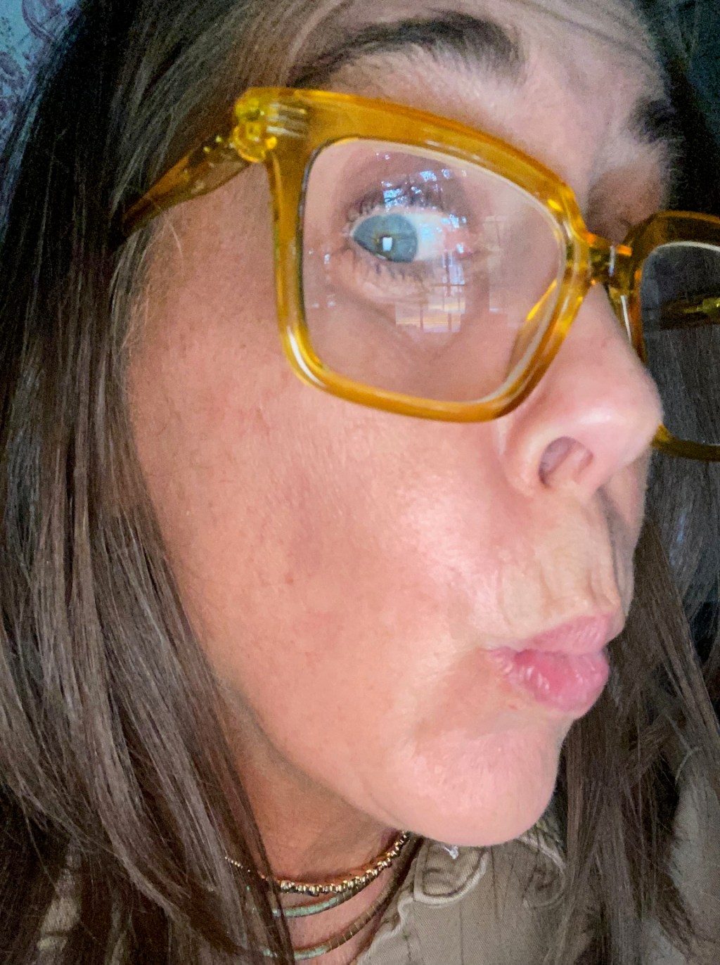 Face fuzz and&nbsp;TP